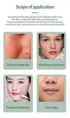 LED Acne Spot Pen
