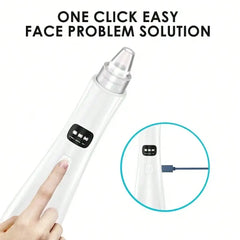 A white handheld blackhead vacuum pore cleaner with a clear nozzle and a charging cable.