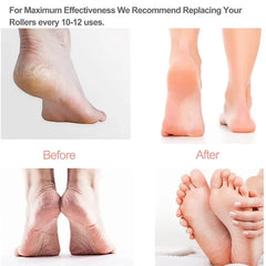 Rechargeable Electric Foot Callus Remover Tool