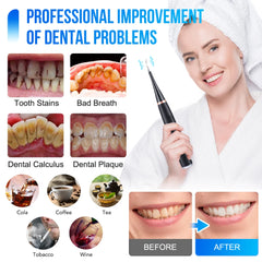 Electric Dental Scaler Oral Irrigator USB Rechargeable Teeth Cleaner