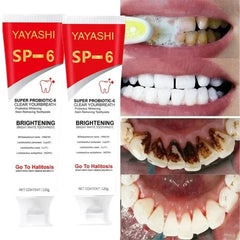 Two tubes of Yayashi SP-6 probiotic whitening toothpaste shown next to before and after photos.