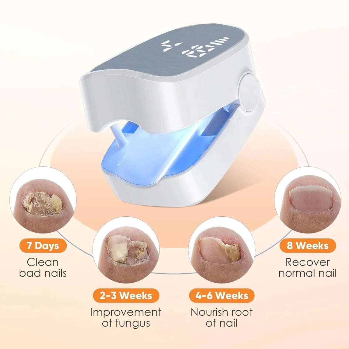 Rechargeable Fireurus Nail Fungus Laser Device for damaged, thick, and discolored nails, used for fungal nail treatment.