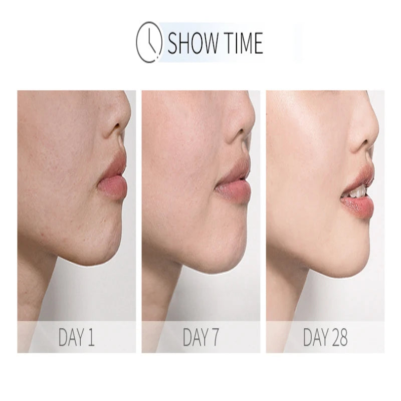 HD image of Showlu Fashion Store's LAIKOU Nicotinamide Serum bottle for face, highlighting moisturizing, anti-aging, and pore-shrinking benefits.