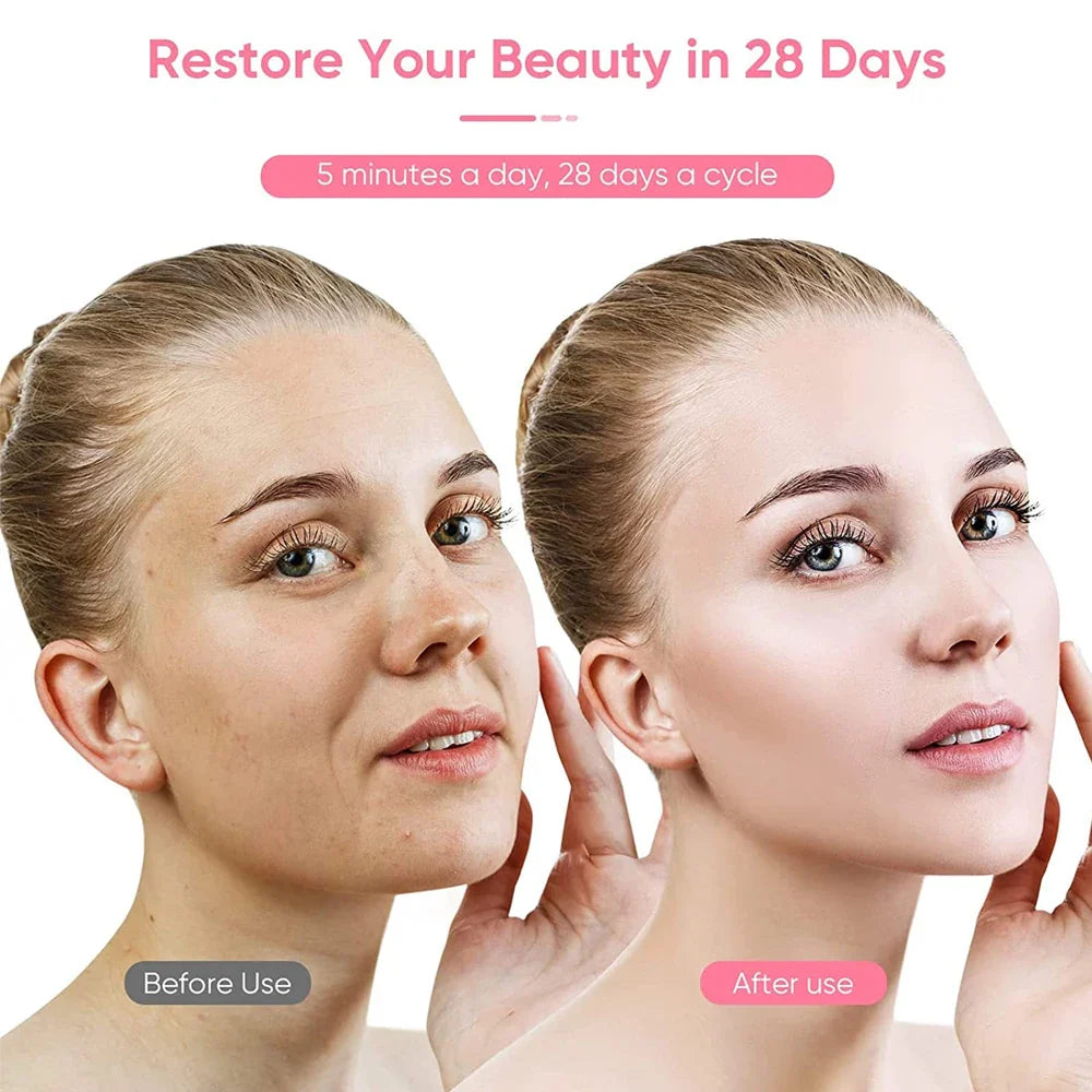 SHOWLU FASHION STORE BXA Microcurrent Face Lift Machine EMS Face Roller for skin tightening and facial rejuvenation.