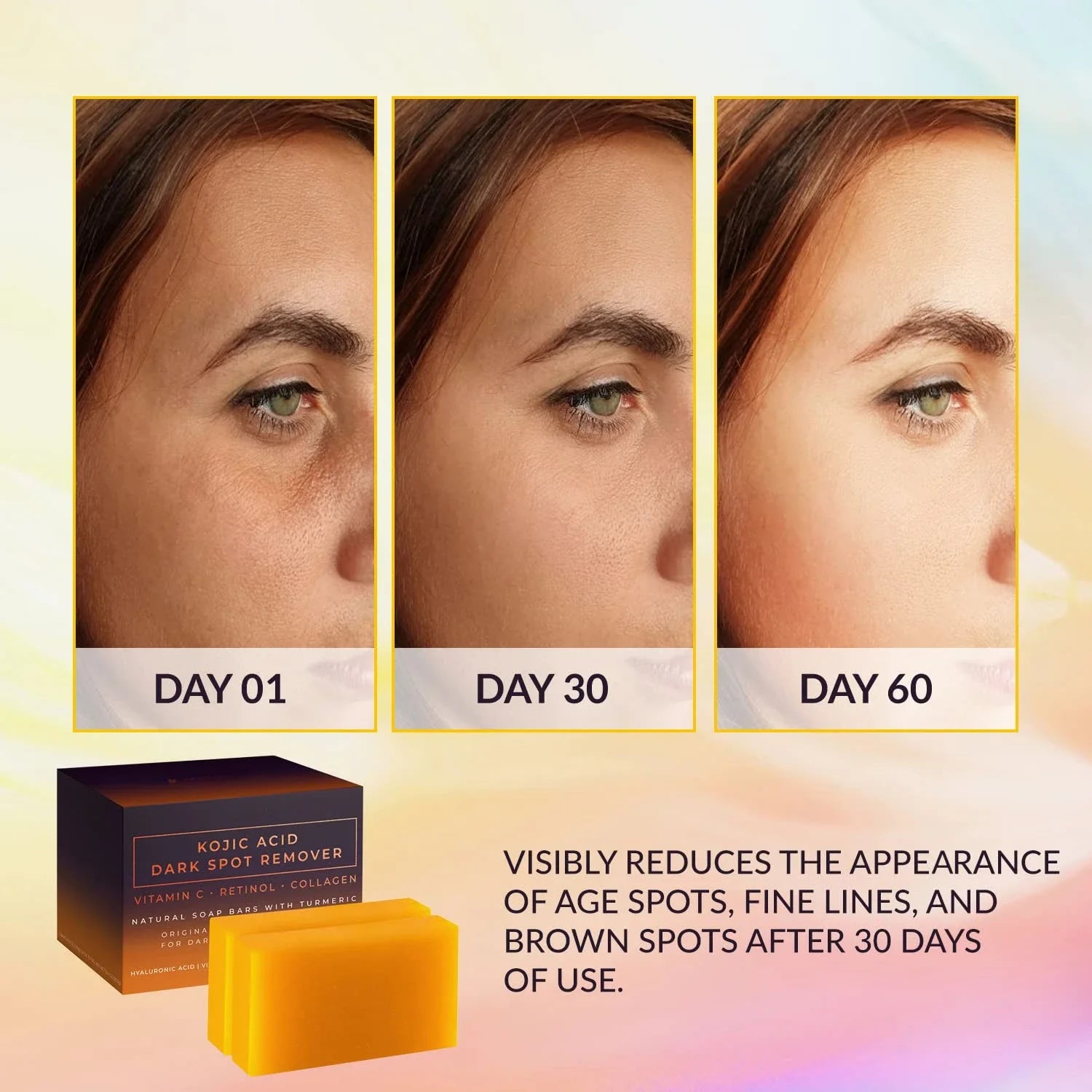 Handmade Kojic Acid dark spot remover soap by Showlu Fashion Store showing the whitening, deep cleansing, and moisturizing soap bar.