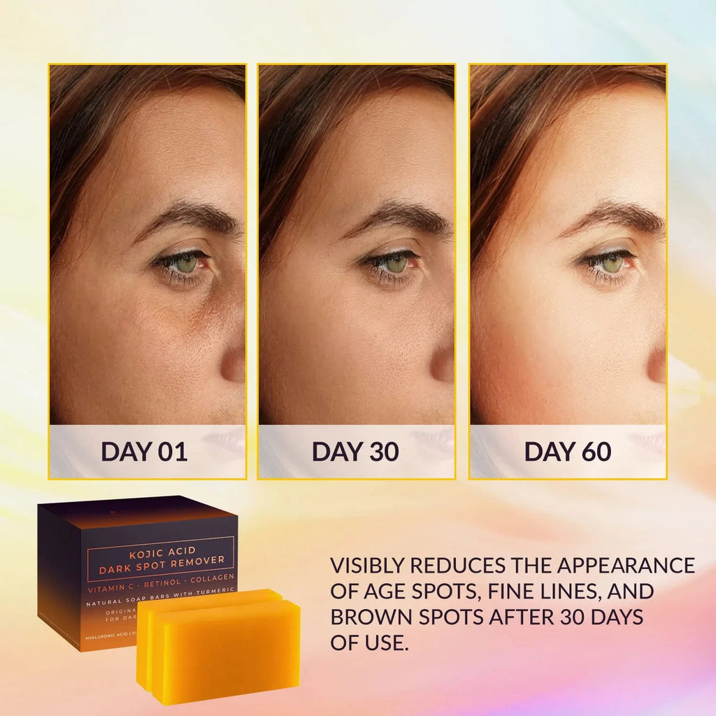 Handmade Kojic Acid Dark Spot Remover whitening soap with deep cleaning and moisturizing properties, brightening skin naturally.