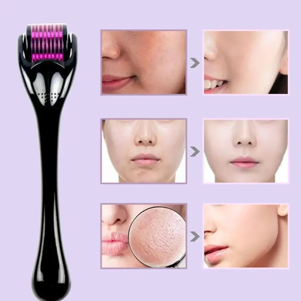 Showlu Smart General beard growth roller with fine metal microneedles for stimulating facial hair growth.