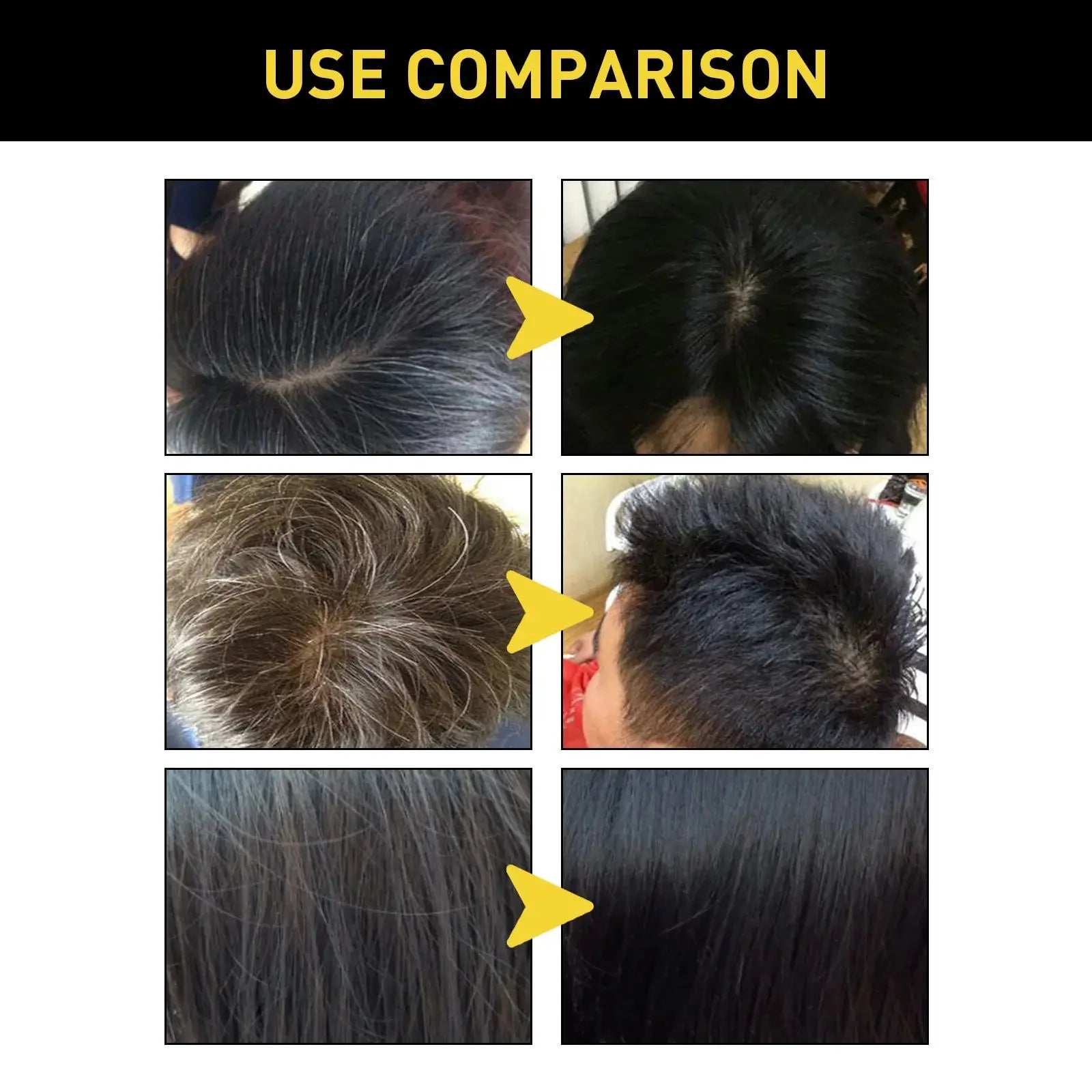 Eelhoe Black Hair Dye Shampoo by SHOWLU FASHION STORE, 100ml bottle with natural Polygonum hair cover for gray hair.