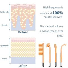 Facial Skin Care High Frequency Facial Wand Portable Hand-Held High Frequency Facial Machine with 4 Pcs Different Tubes