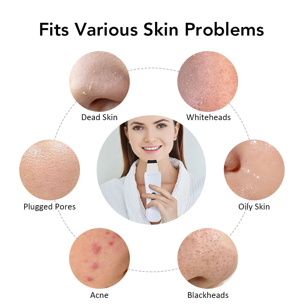 Showlu Smart Ultrasonic Skin Scrubber with EMS pore cleaner and lifting tool, handheld device for facial skin rejuvenation and deep cleaning.
