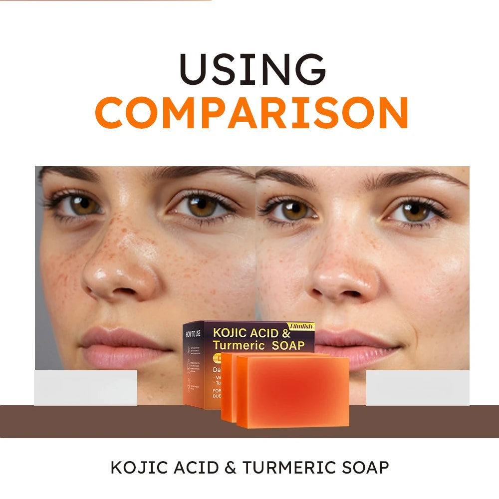 200g Showlu Fashion Store Kojic Acid Turmeric Soap for dark spot removal and skin brightening with turmeric extract.