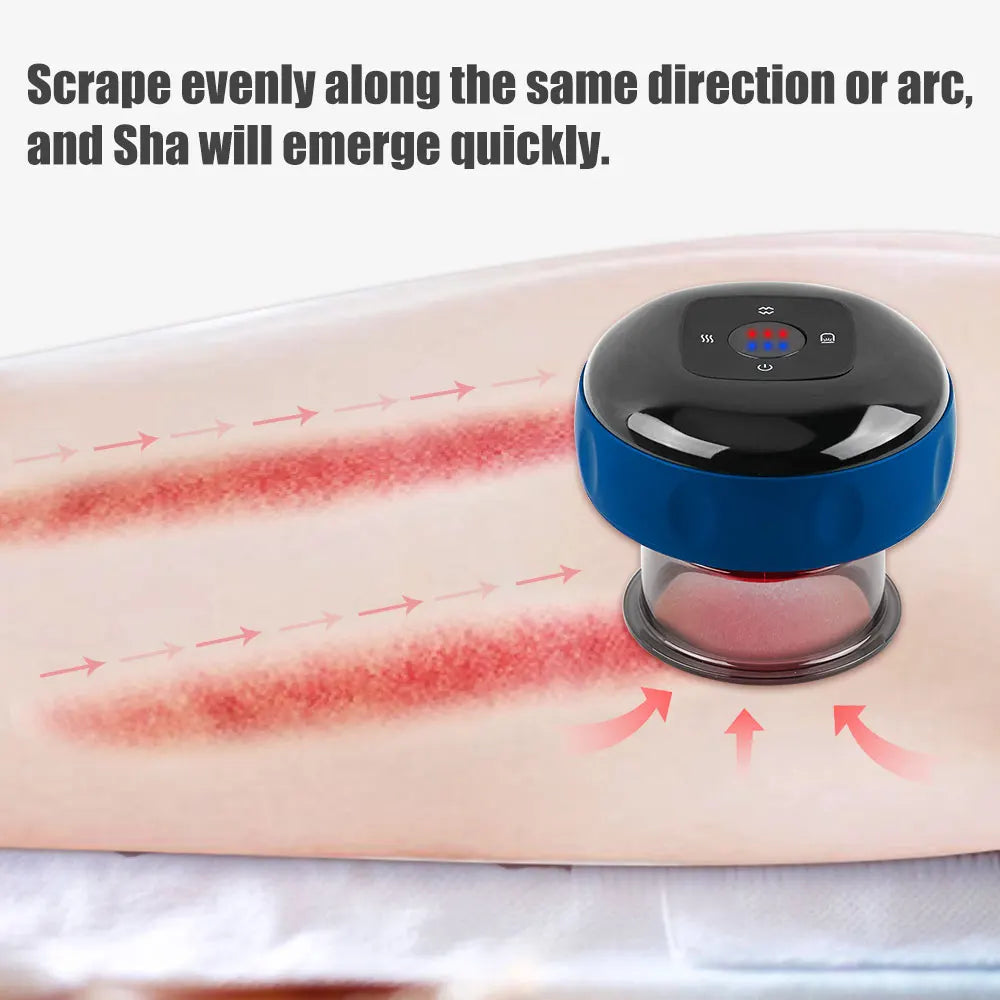 SUOLAER Electric Cupping Therapy Set with vacuum scraping massager, showing multiple cups and control device for massage therapy.