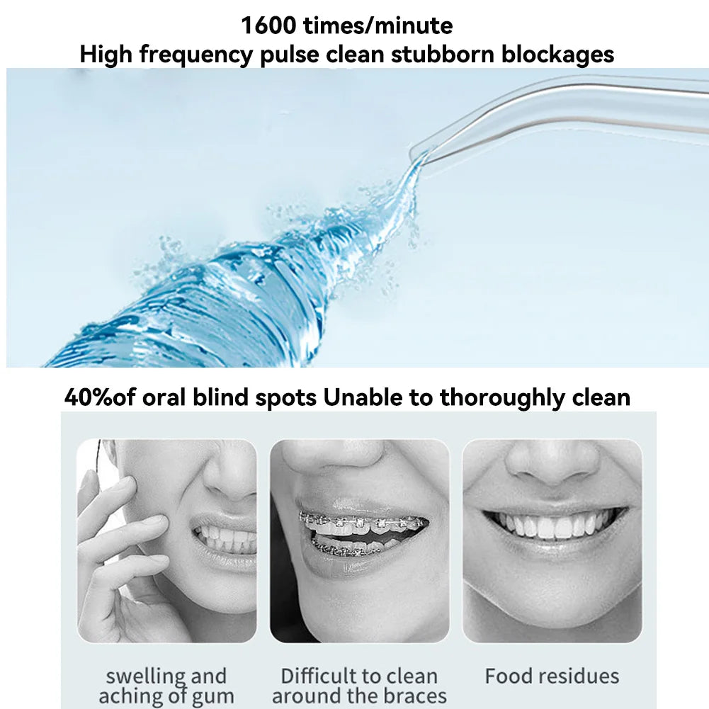 Showlu Smart portable USB rechargeable oral irrigator with 200ml water tank and IP65 waterproof design, ideal for oral hygiene.