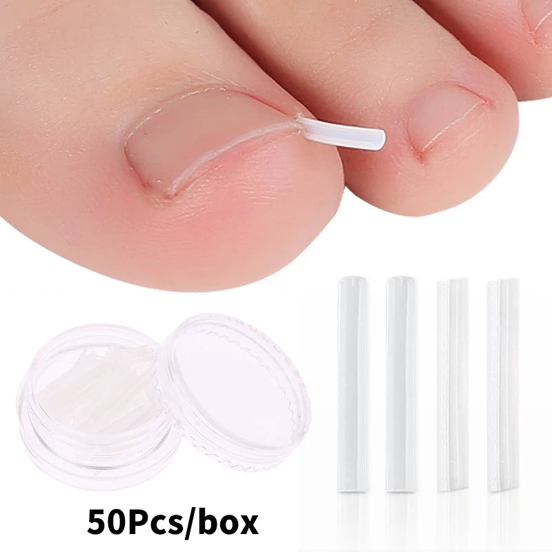 Set of 50 Showlu Fashion ingrown toenail correction tools with elastic patch stickers and straightening clips for pedicure treatment.
