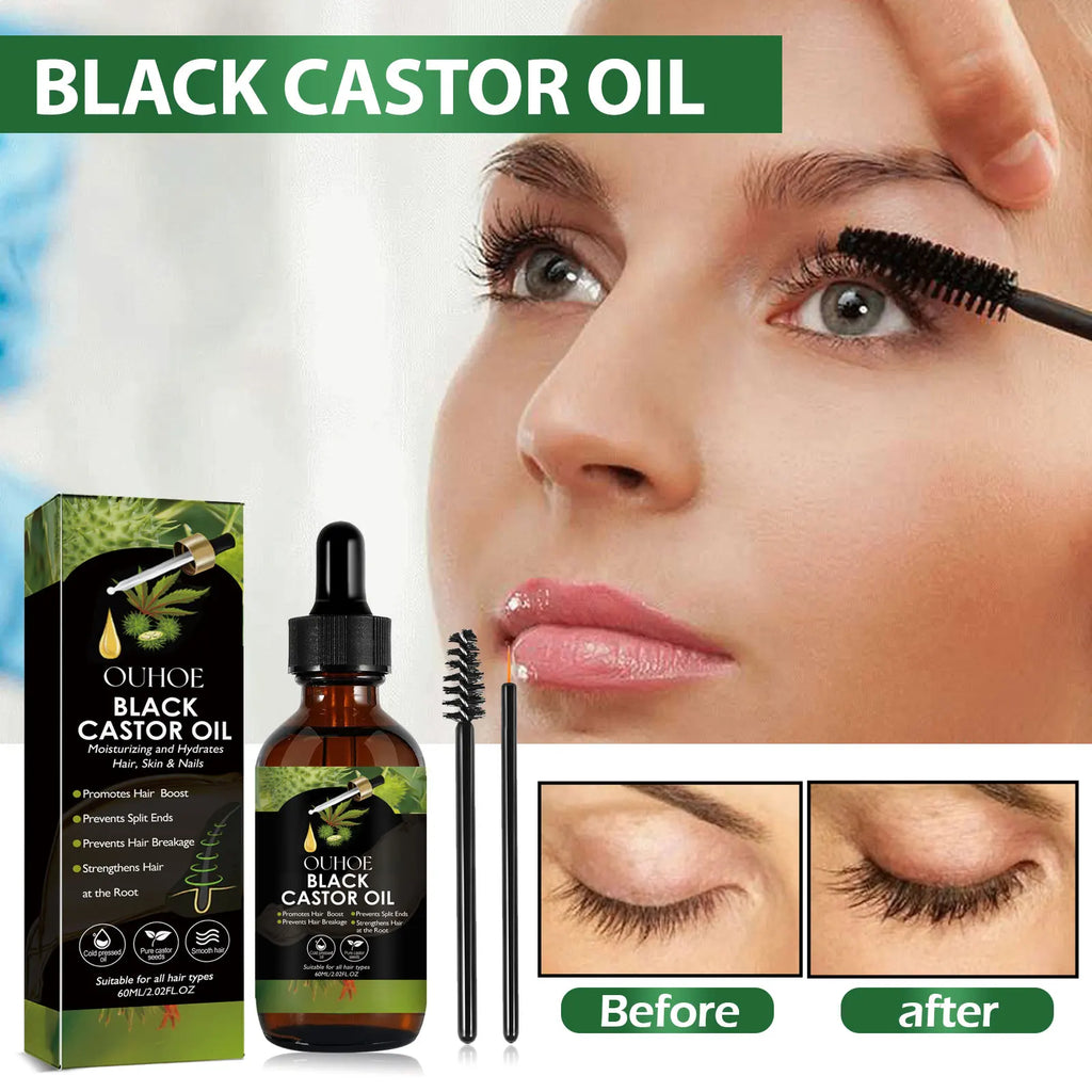 Black castor oil serum bottle from Showlu Fashion Store, 100% organic hair growth treatment for hair loss and scalp nourishment.