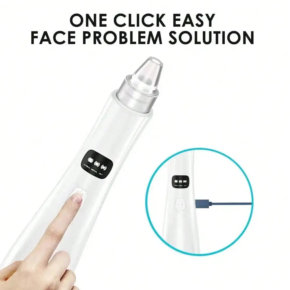 Showlu Smart blackhead vacuum pore cleaner with electric suction, featuring a sleek black design for facial pore extraction.