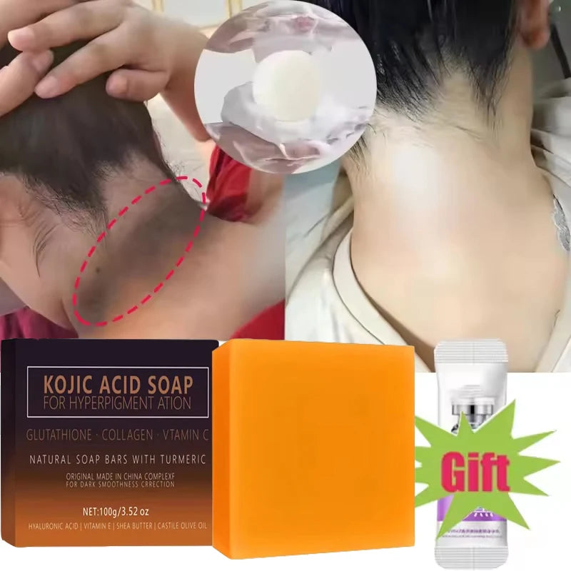 Showlu Fashion Kojic Acid Dark Spot Remover Whitening Soap, handmade skin care soap with deep cleaning and moisturizing properties.