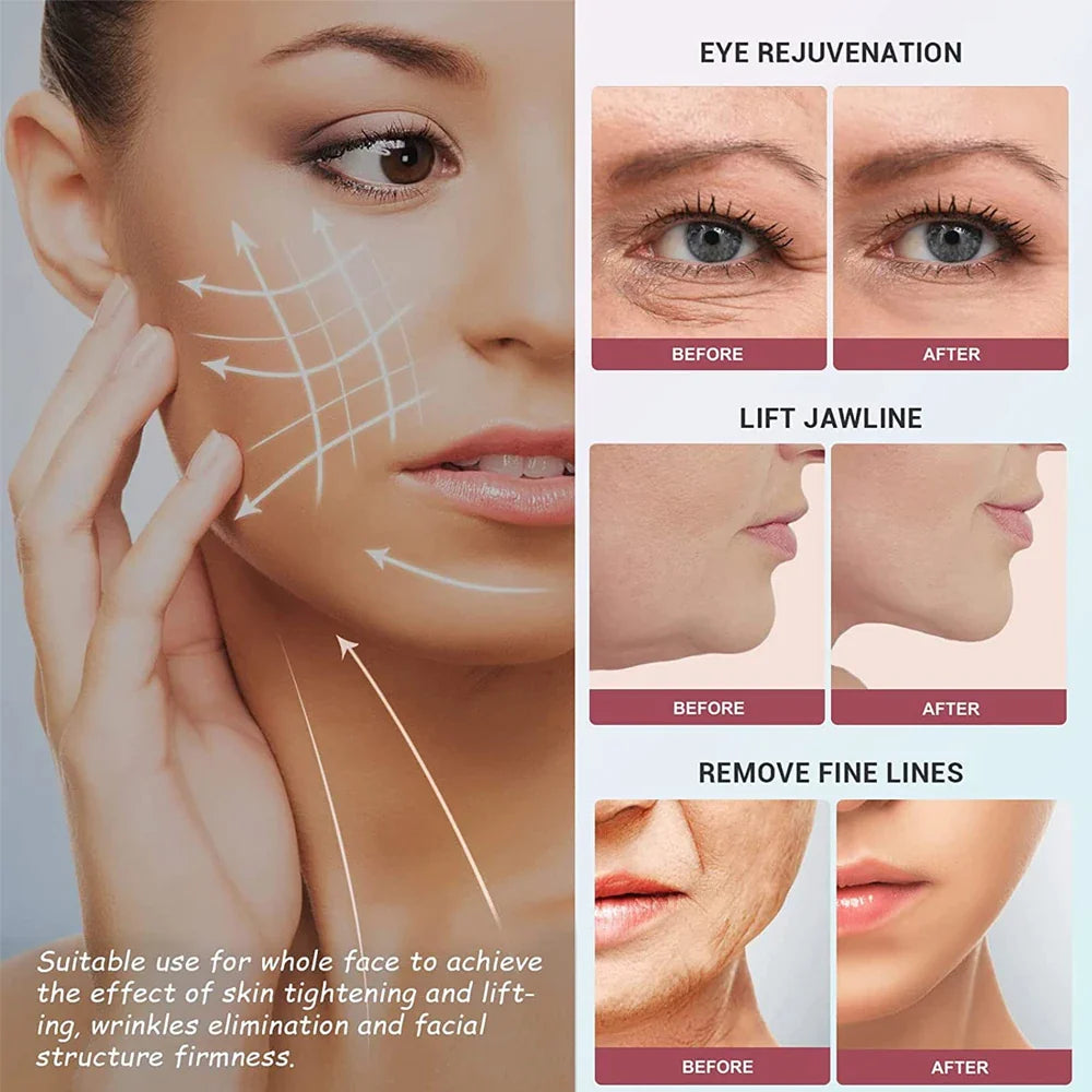 SHOWLU FASHION STORE BXA Microcurrent Face Lift Machine with EMS face roller for skin tightening and facial rejuvenation.