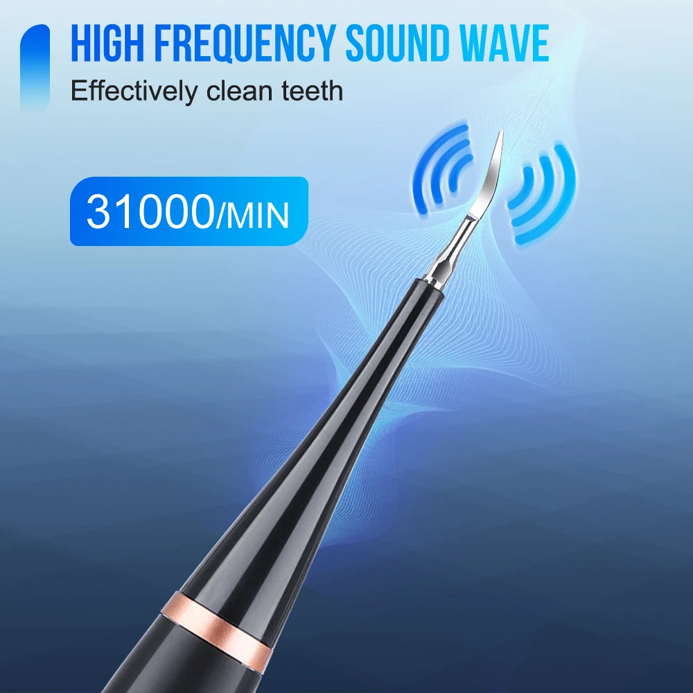 Showlu Smart Electric Dental Scaler and Oral Irrigator, USB rechargeable teeth cleaning device with water jet for oral hygiene.