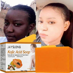 100g Kojic Acid Soap Original Papaya Soap Face Body Whitening Handmade Brighten Anti Aging Acne Remove Dark Spot Moisturizing