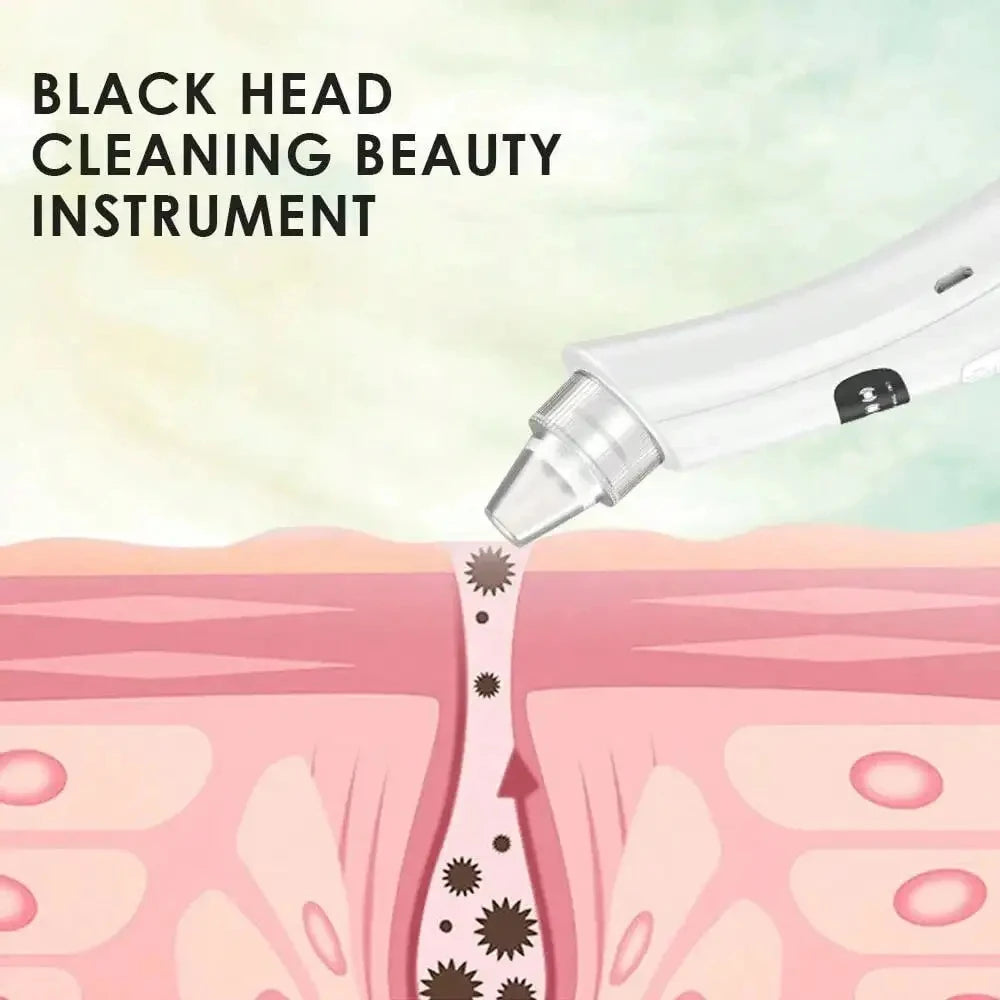 Showlu Smart blackhead vacuum pore cleaner with electric suction, featuring a sleek black design and multiple attachment heads.