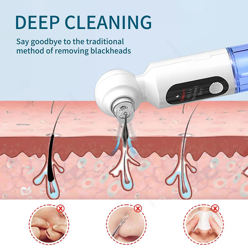 Showlu Smart General Pore Vacuum Pro device with suction head and control buttons for deep pore cleaning.
