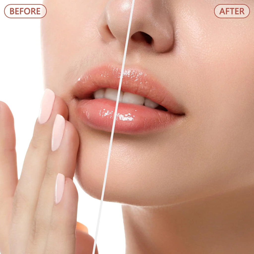 Electric facial hair remover for women by Showlu Fashion Store, painless face shaver for lips, peach fuzz, and facial hair removal.