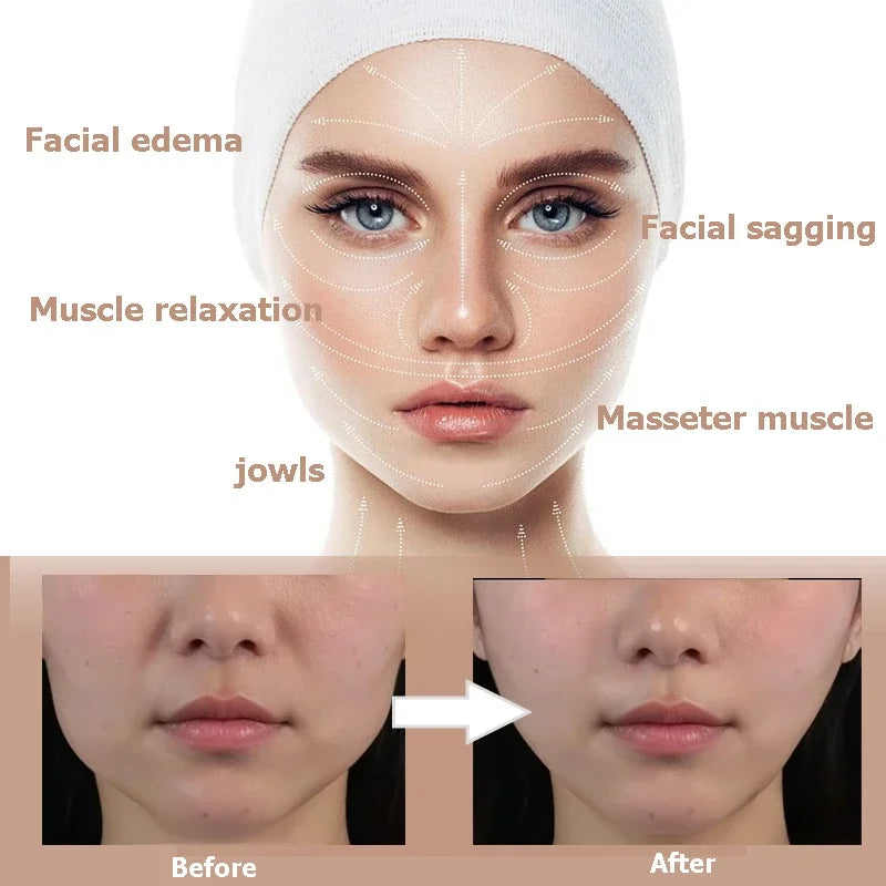 Invisible V Lift face sticker tape by Showlu Smart General, showing the clear, skin-toned tape for natural face lifting.
