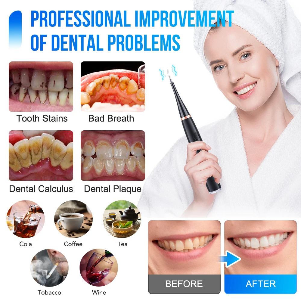 Showlu Smart Electric Dental Scaler and Oral Irrigator with USB recharge, featuring a compact design for teeth cleaning and oral health.