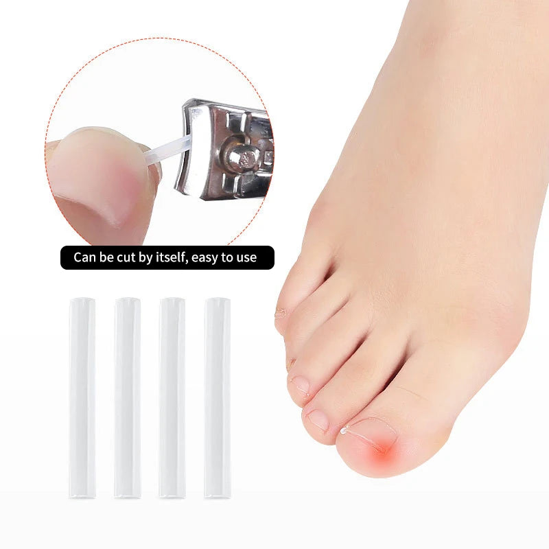 Set of 50 Showlu Fashion ingrown toenail correction tools with elastic patches and straightening clips for pedicure treatment.