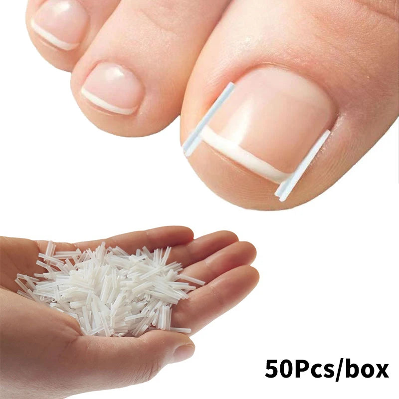 50pcs Showlu Fashion ingrown toenail correction tools with elastic patches and straightening clips for pedicure treatment.