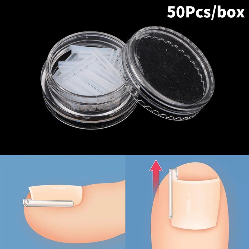 50pcs Showlu Fashion ingrown toenail correction tools with elastic patch stickers and straightening clips for pedicure treatment.