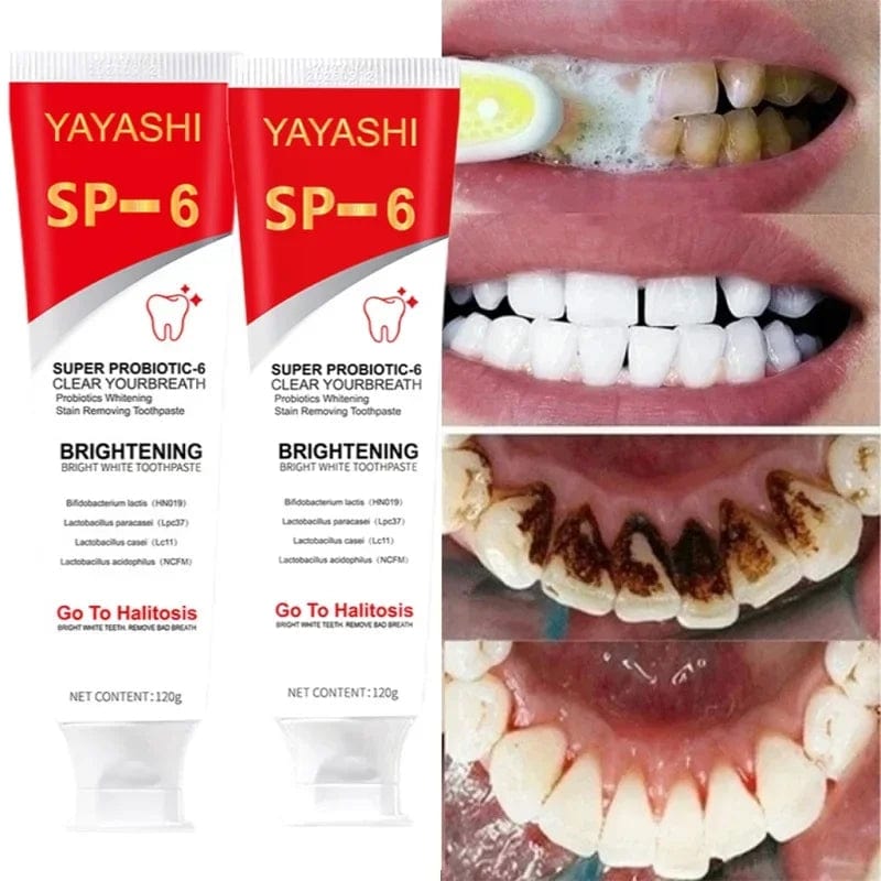 Showlu Fashion Store 1pc 120g 120g Probiotic Toothpaste SP-6 Whitening Tooth Remove Plaque Stains Teeth Whitener Oral Hygiene Clean Fresh Breath Dental