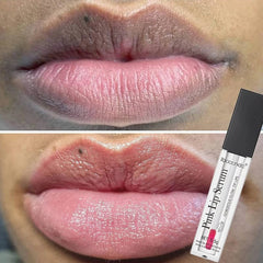 Showlu Fashion Store 1pcs 2023 New Lips Bleach Moisturizing Fresh Serum Effective Reduce Pigmentation Pink Whiten Plumper Sexy Lip Balms Korean Cosmetics