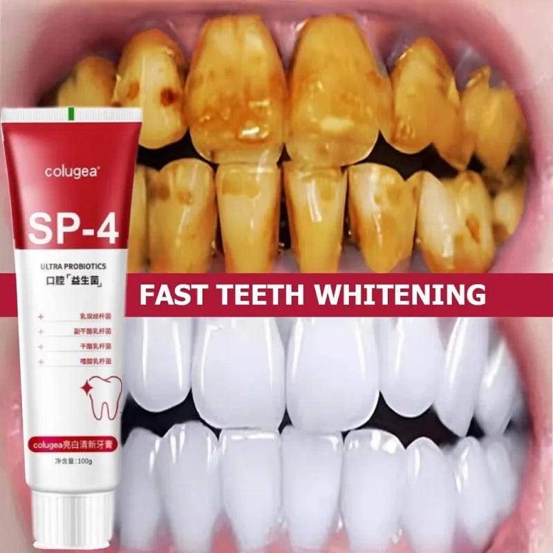  Showlu Fashion Store 3mL 100g Probiotic Toothpaste SP-4 Whitening Tooth Remove Plaque Stains Teeth Whitener Oral Hygiene Clean Fresh Breath Dental New