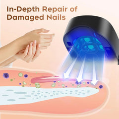 SHOWLU FASHION STORE Black LED Nail Fungus Laser Treatment Device for Cleaning Onychomycosis  USB Charge 905nm Infrared Light 470nm Blue Light Nail Salon