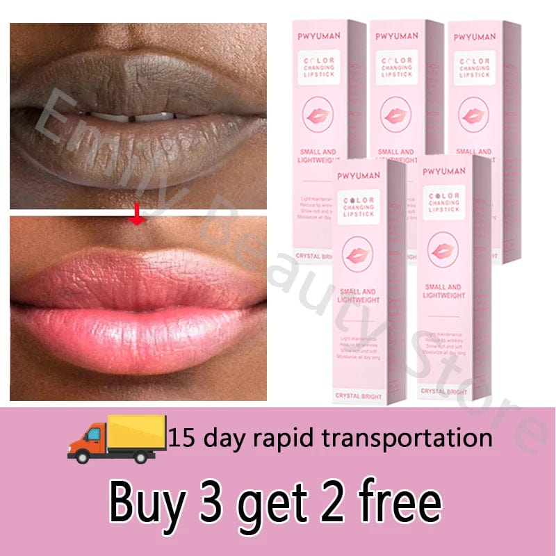 Showlu Fashion Store Buy 3 get 2 free 2023 New Lips Bleach Moisturizing Fresh Serum Effective Reduce Pigmentation Pink Whiten Plumper Sexy Lip Balms Korean Cosmetics