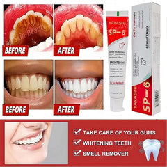  Showlu Fashion Store New Probiotic Toothpaste SP-6 Whitening Tooth Remove Plaque Stains Teeth Whitener Oral Hygiene Clean Fresh Breath Denta 120g