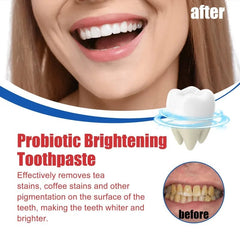  Showlu Fashion Store Probiotic BrighteningToothpaste  SP-6 Whitening Tooth Remove Plaque Stains Teeth Whitener Oral Hygiene Clean Fresh Breath Care