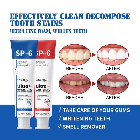  Showlu Fashion Store Probiotic BrighteningToothpaste  SP-6 Whitening Tooth Remove Plaque Stains Teeth Whitener Oral Hygiene Clean Fresh Breath Care