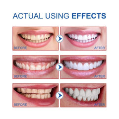  Showlu Fashion Store Probiotic BrighteningToothpaste  SP-6 Whitening Tooth Remove Plaque Stains Teeth Whitener Oral Hygiene Clean Fresh Breath Care