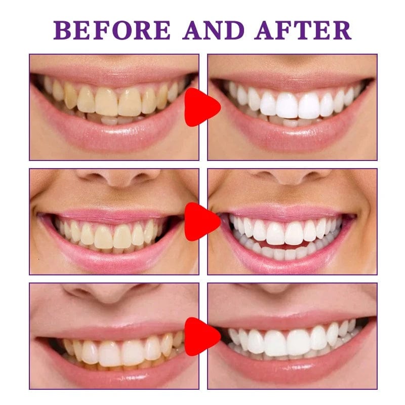  Showlu Fashion Store Purple White Teeth Toothpaste Cleans Teeth Stains Tartar Bad Breath Freshens Oral Odor Reduce Yellow Teeth Bleeding Gums Care