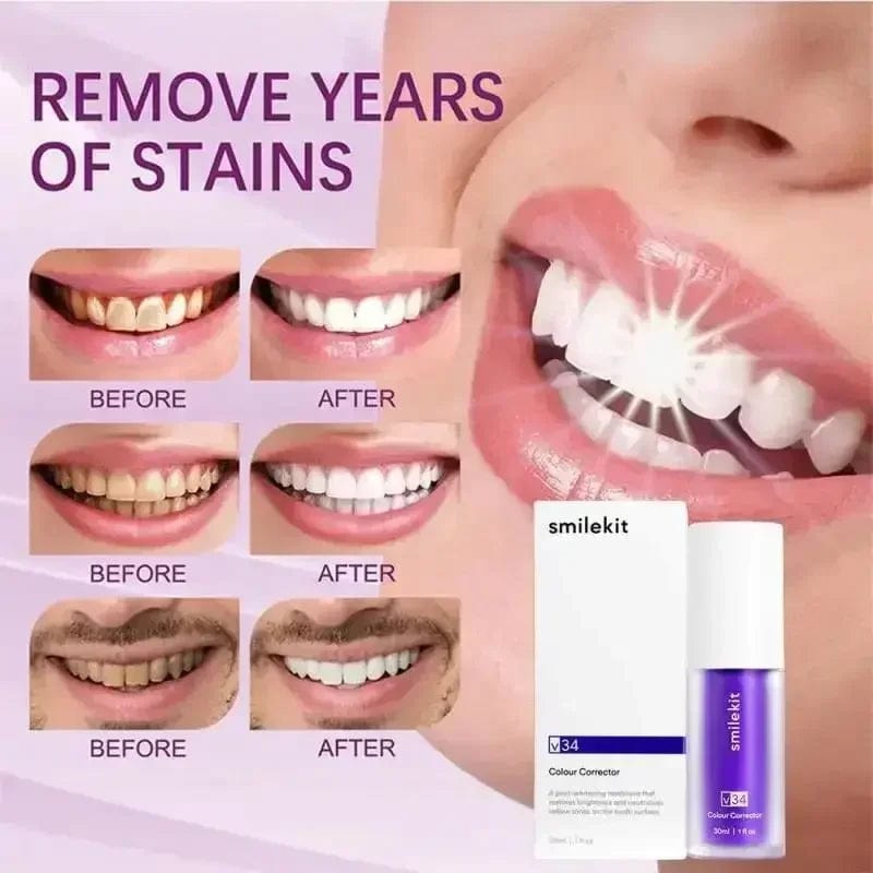  Showlu Fashion Store SMILEKIT V34 Purple Whitening Toothpaste Remove Smoke Stain Remove Stains Reduce Yellowing Care For Teeth Gums Fresh Breath