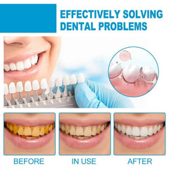  Showlu Fashion Store Teeth Whitening Mousse Toothpaste Remove Against Dental Caries Plaque Dirt Serum Fresh Breath Oral Hygiene Dental Tooth