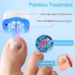 SHOWLU FASHION STORE White Nail Fungus Treatment Tools Fungal Nail Treatment Anti-Equipment Effectively Remove Fungal Toenail Nail Fungal Infection