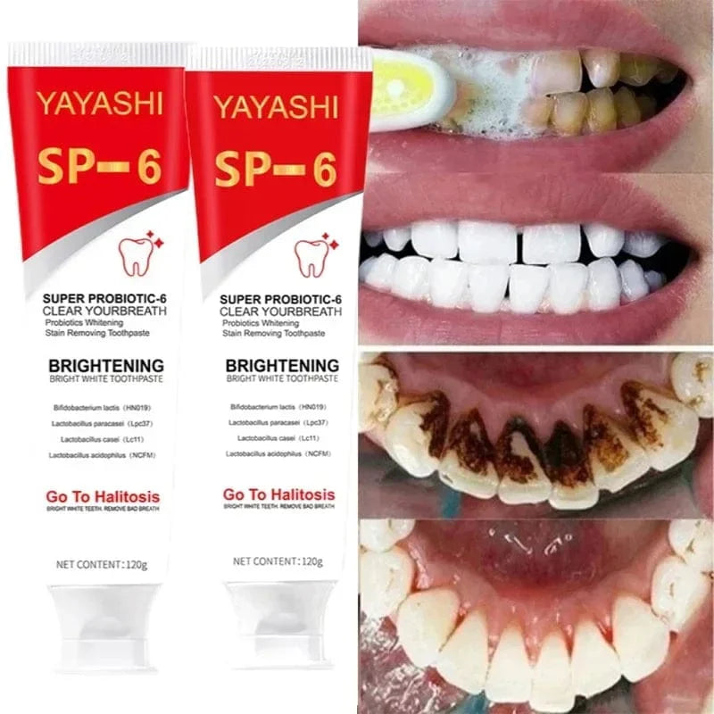 Eelhoe SP-6 Probiotic Whitening Toothpaste in 120g with plaque and stain removal for fresh, clean teeth and oral hygiene.